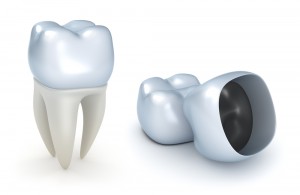 dental crowns