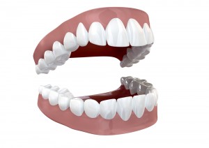 separated set of teeth