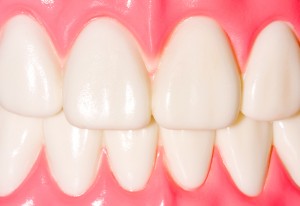 closeup model of teeth