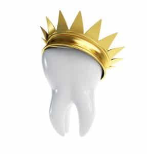 Beautiful Dental Crowns