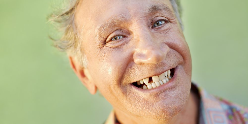 senior man smiling after tooth extraction