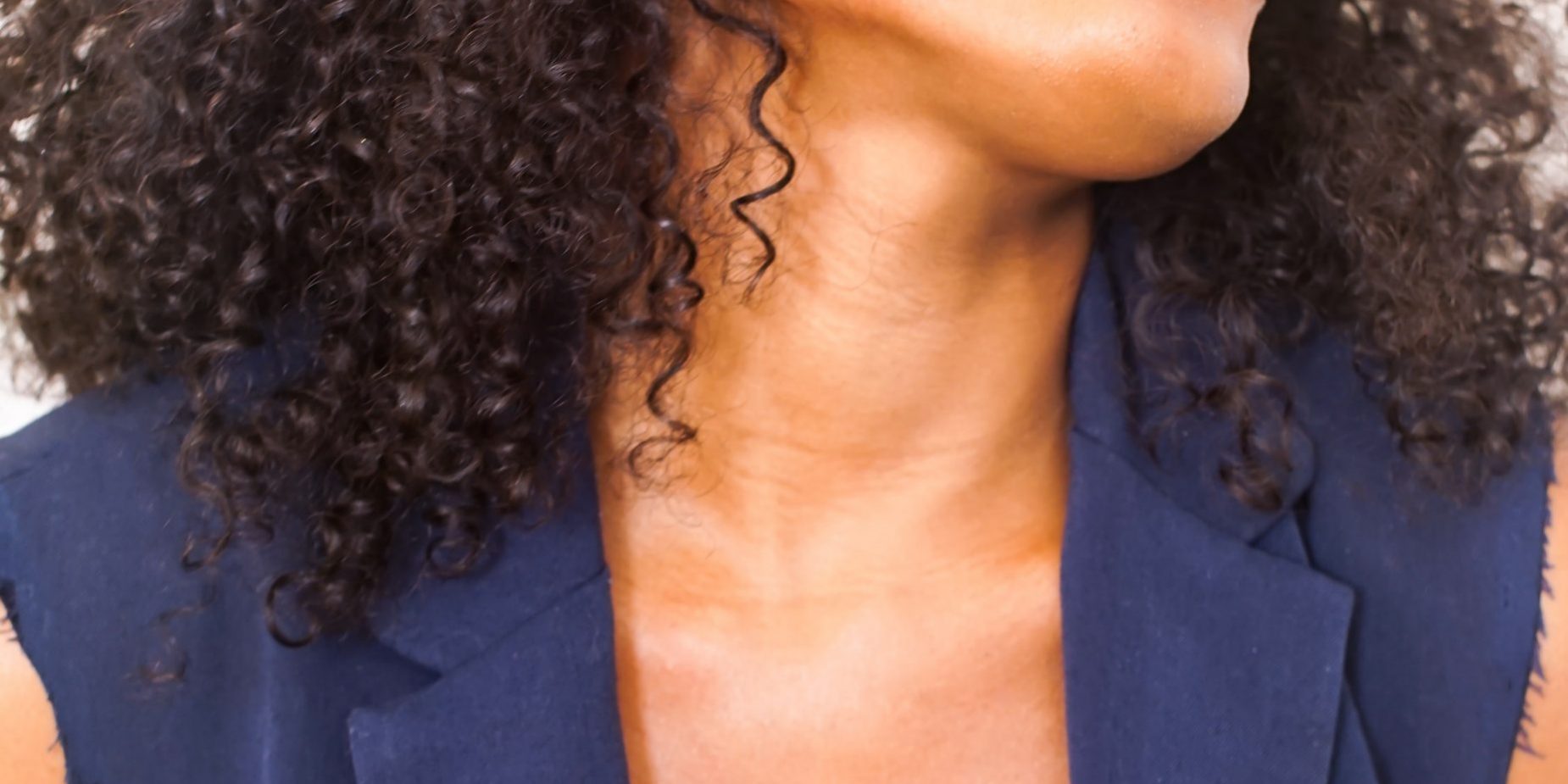 A young, Black woman smiles widely after orthodontics A young, Black woman smiles widely after orthodontics